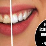 Alt-cost of tooth extraction